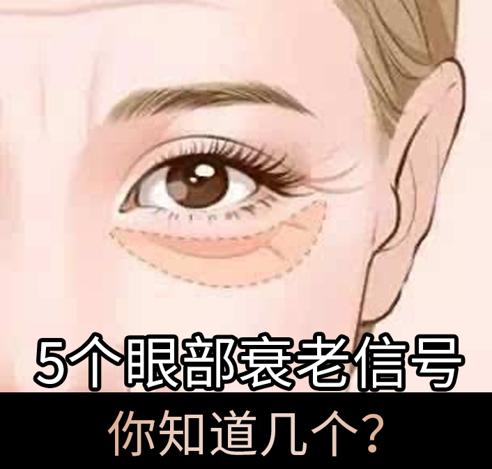 5个眼部衰老信号，你知道几个？
