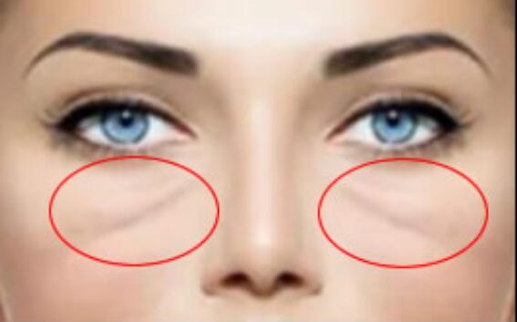 撕掉岁月痕迹！提拉紧致美容仪助你闪耀