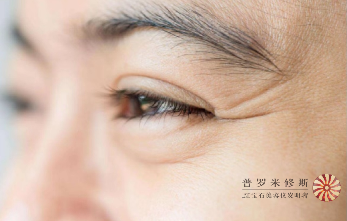 烙铁们，你的鱼尾纹真的需要熨一下！