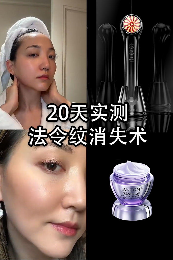 20天实测，法令纹消失术！射频美容仪CP推荐