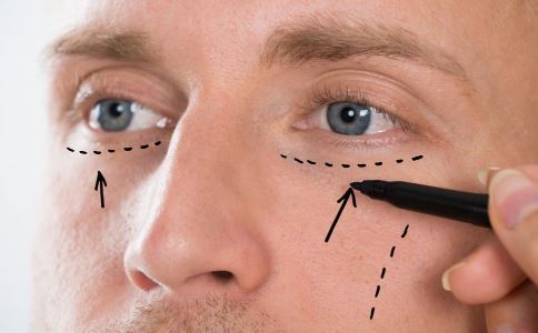 激光祛痘印四大优势：轻松拥有干净肌肤的秘密！