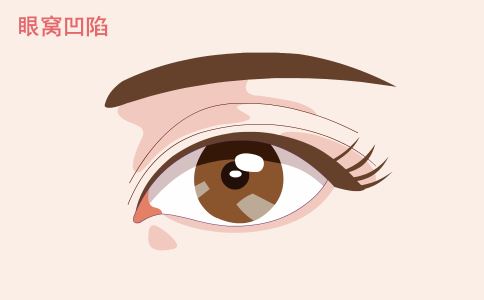 打造无痕肌肤，选择激光祛痘印就是关键！