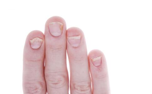 轻松拥有光滑肌肤：祛痘印小妙招让你告别痘痕！