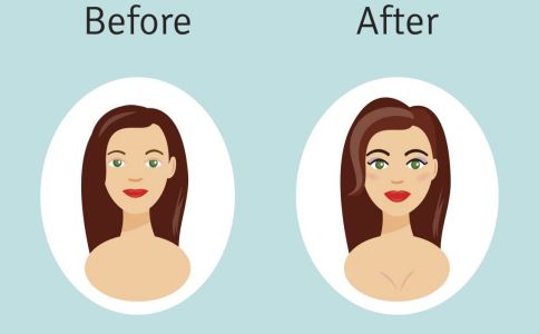 激光祛痘印的优势：专为女性设计，美丽升级！