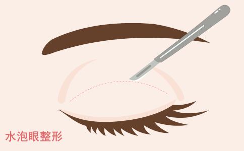 激光祛斑：了解原理，遵循术前术后要求，美丽肌肤轻松得！
