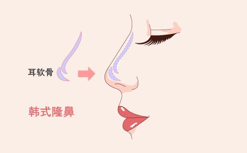 女性专属：月经周期影响激光祛斑效果，如何选择最佳时间？