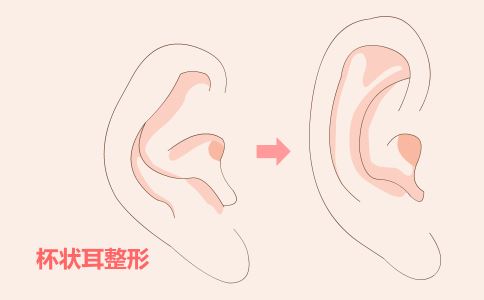 黑脸娃娃是什么 美白肌肤又淡斑