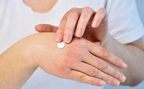 对症下药美肤计 轻松祛痘不留痕