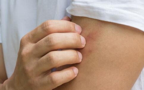 芳香精油理疗法祛痘