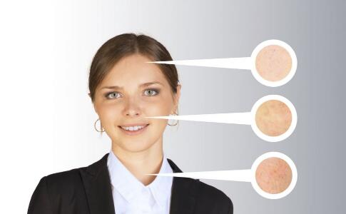 药监局：祛痘异维A酸致畸形 两年内不能要小孩