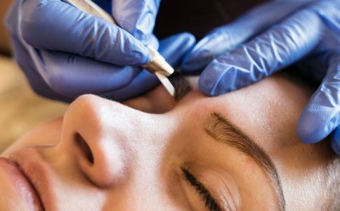 祛痘小妙招 教你轻松去除痘印