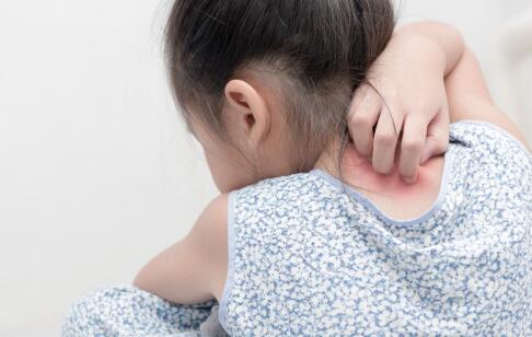 祛痘太难了？强烈安利ORDET痘肌凉茶，对痘印痘坑都有效！