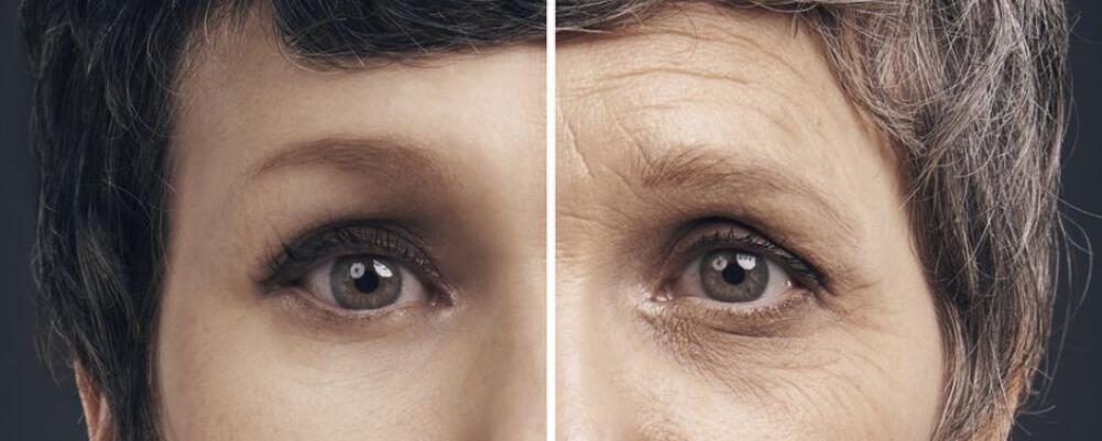 消除颈部皱纹的7个方法