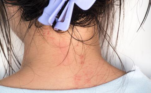 最真实有效的祛皱方法