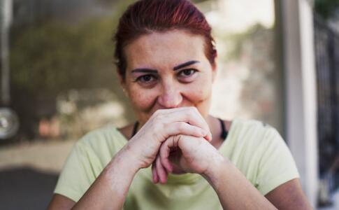 皱纹说明你的身体健康