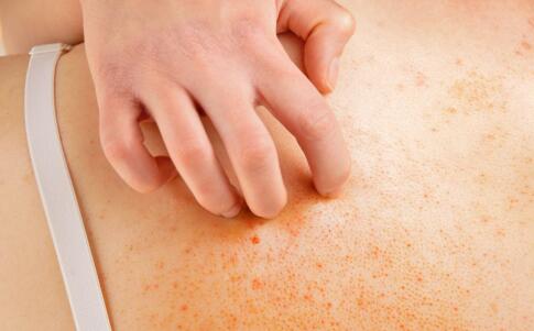 怎么选择祛除皱纹方法