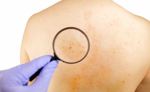 女性怎么按摩祛除皱纹