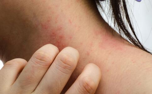 自制水果面膜防皱消除皱纹