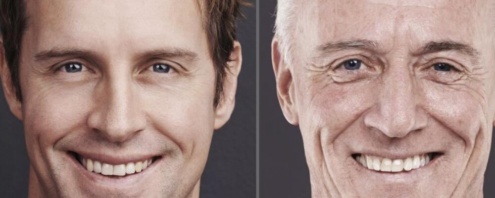 想要祛除鱼尾纹？中医祛皱方法赶走鱼尾纹